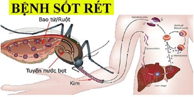 Hướng đến loại trừ sốt rét tại Việt Nam vào năm 2030