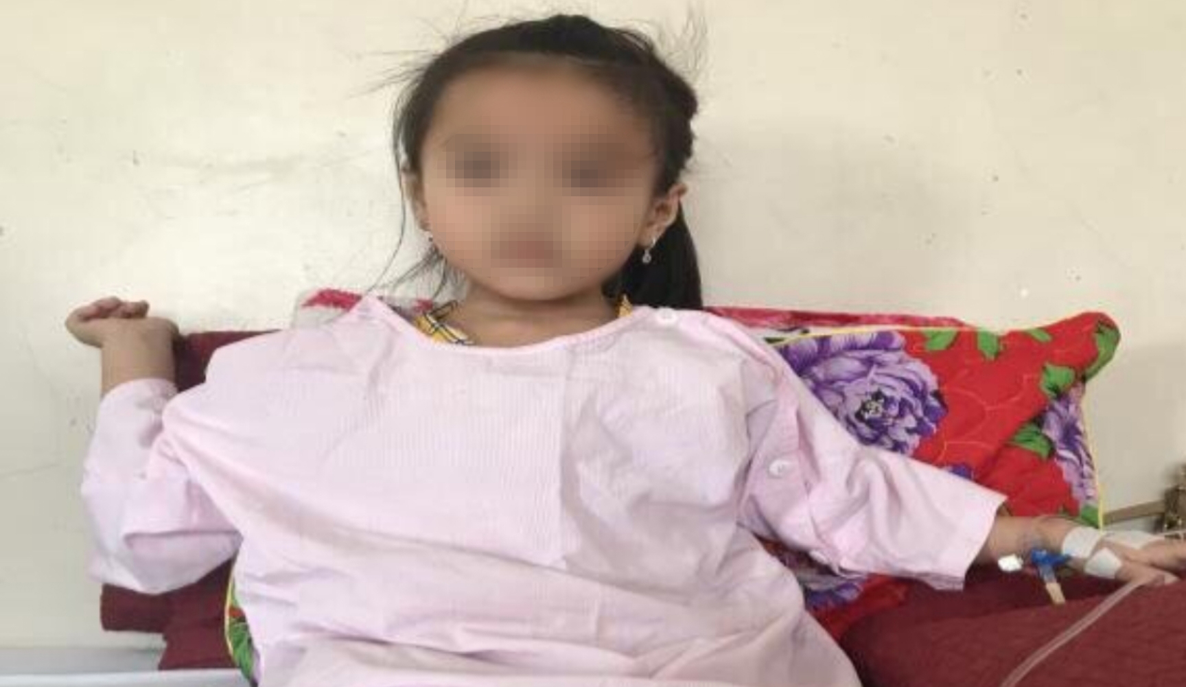 Lấy sỏi ống mật chủ cho bệnh nhi bằng kỹ thuật nội soi mật tụy ngược dòng