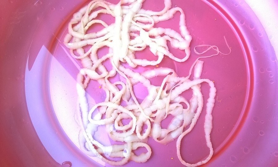 Xổ sán xơ mít dài 3m cho cháu bé 10 tuổi bằng thuốc y học cổ truyền