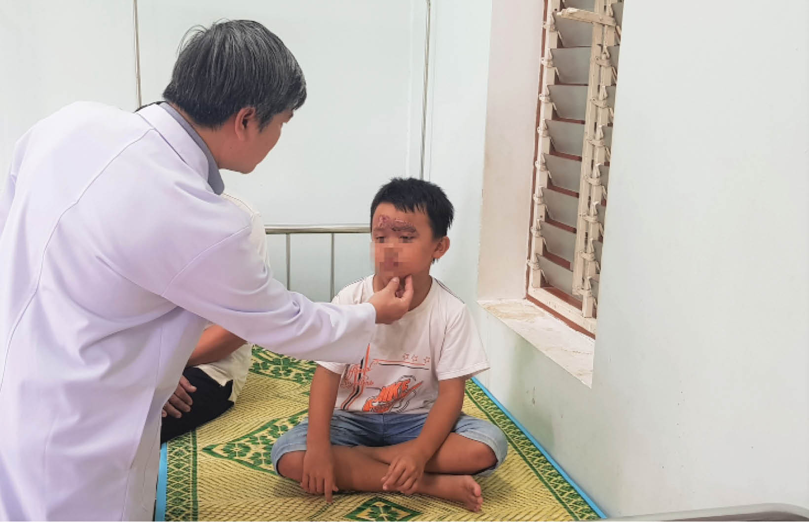 Không coi thường viêm bỏng da do kiến ba khoang