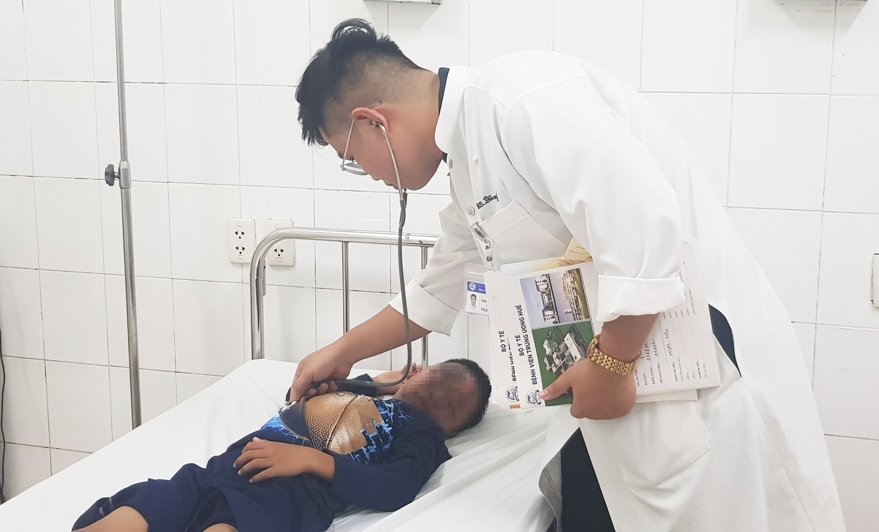 Cảnh báo bỏng do pháo tự chế