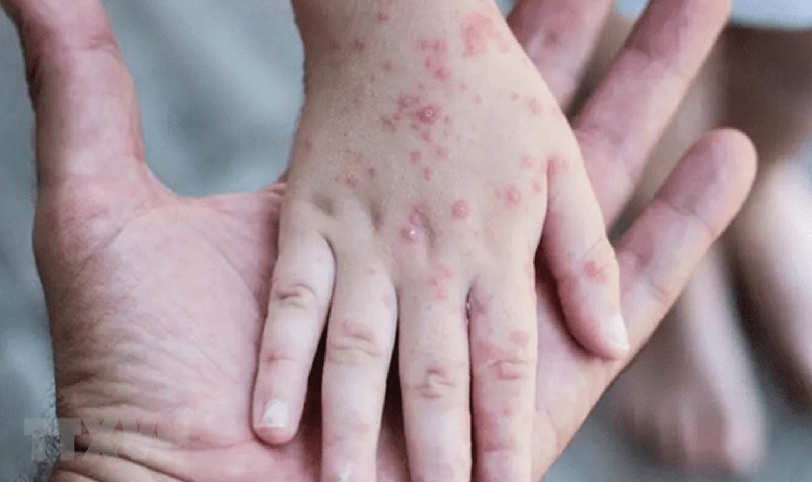 Cần rút bài học từ Covid-19