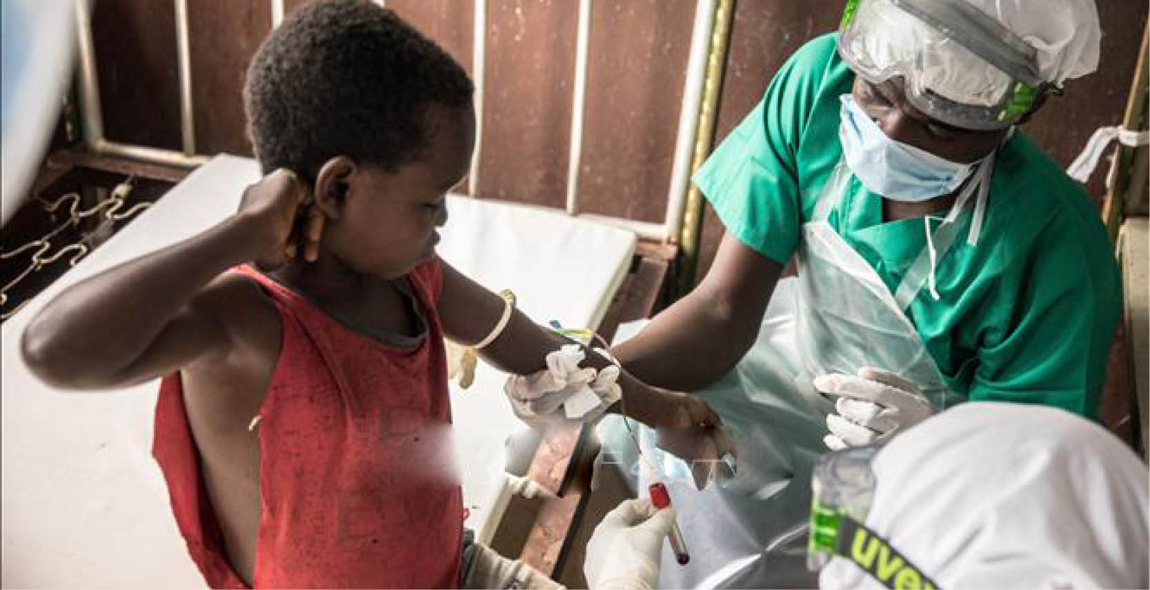 WHO tuyên bố “có thể ngăn chặn được” sự bùng phát bệnh đậu mùa khỉ