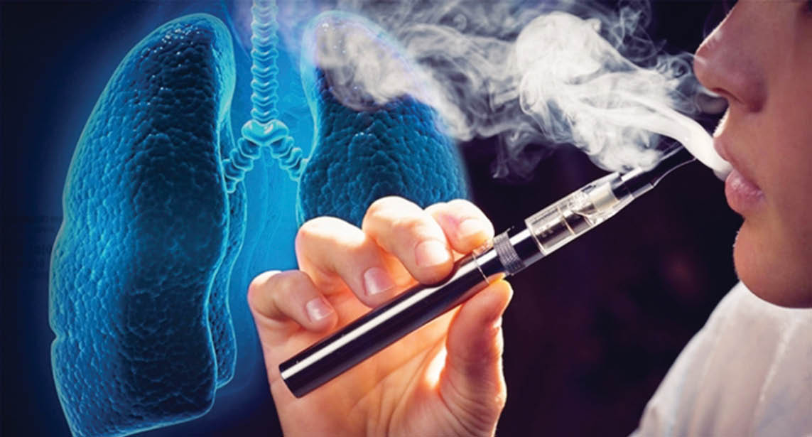 Tỷ lệ thanh thiếu niên hút thuốc lá điện tử tại Mỹ giảm xuống mức thấp nhất trong một thập kỷ