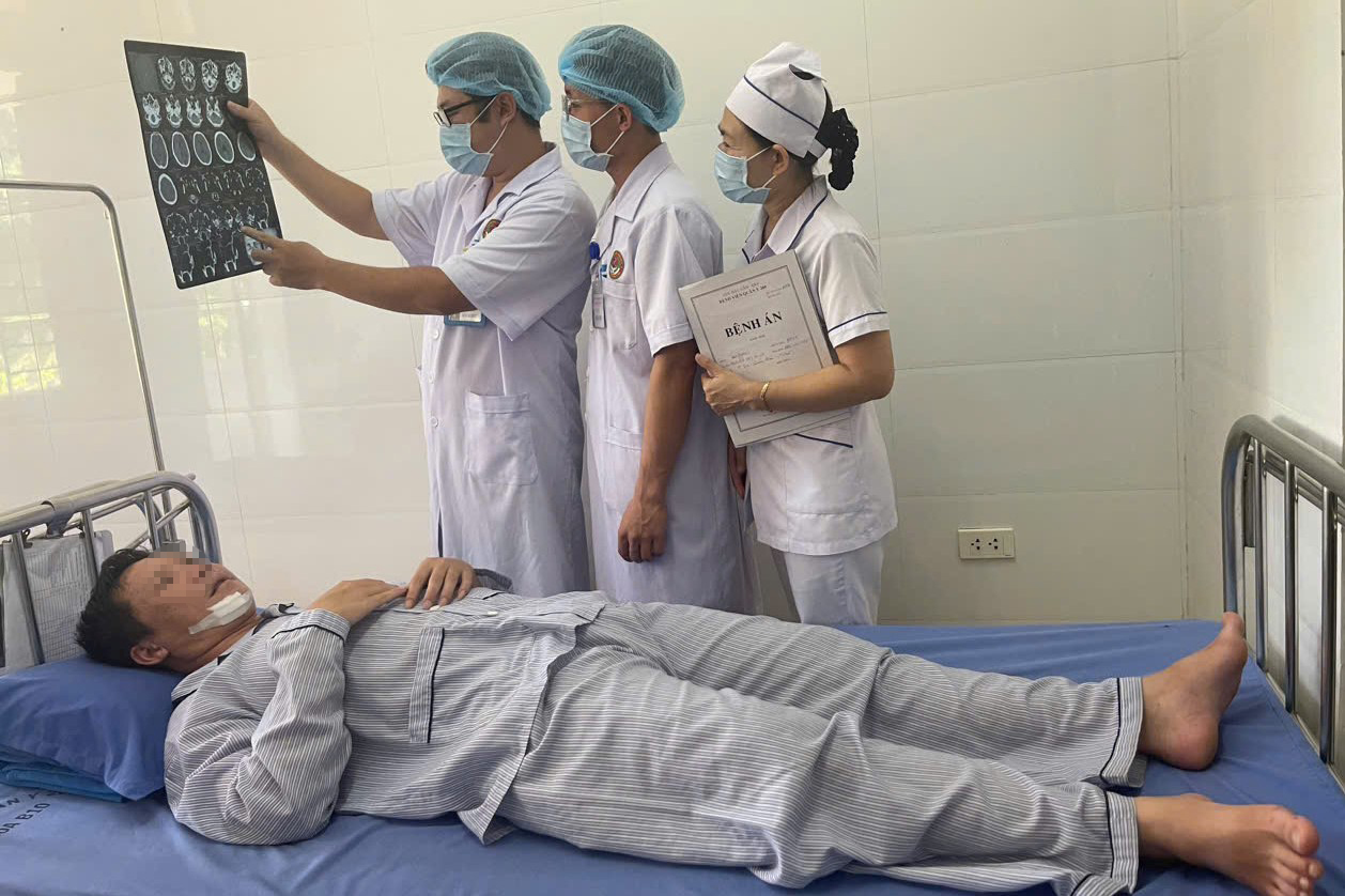 Phẫu thuật thành công ca gãy phức hợp xương gò má