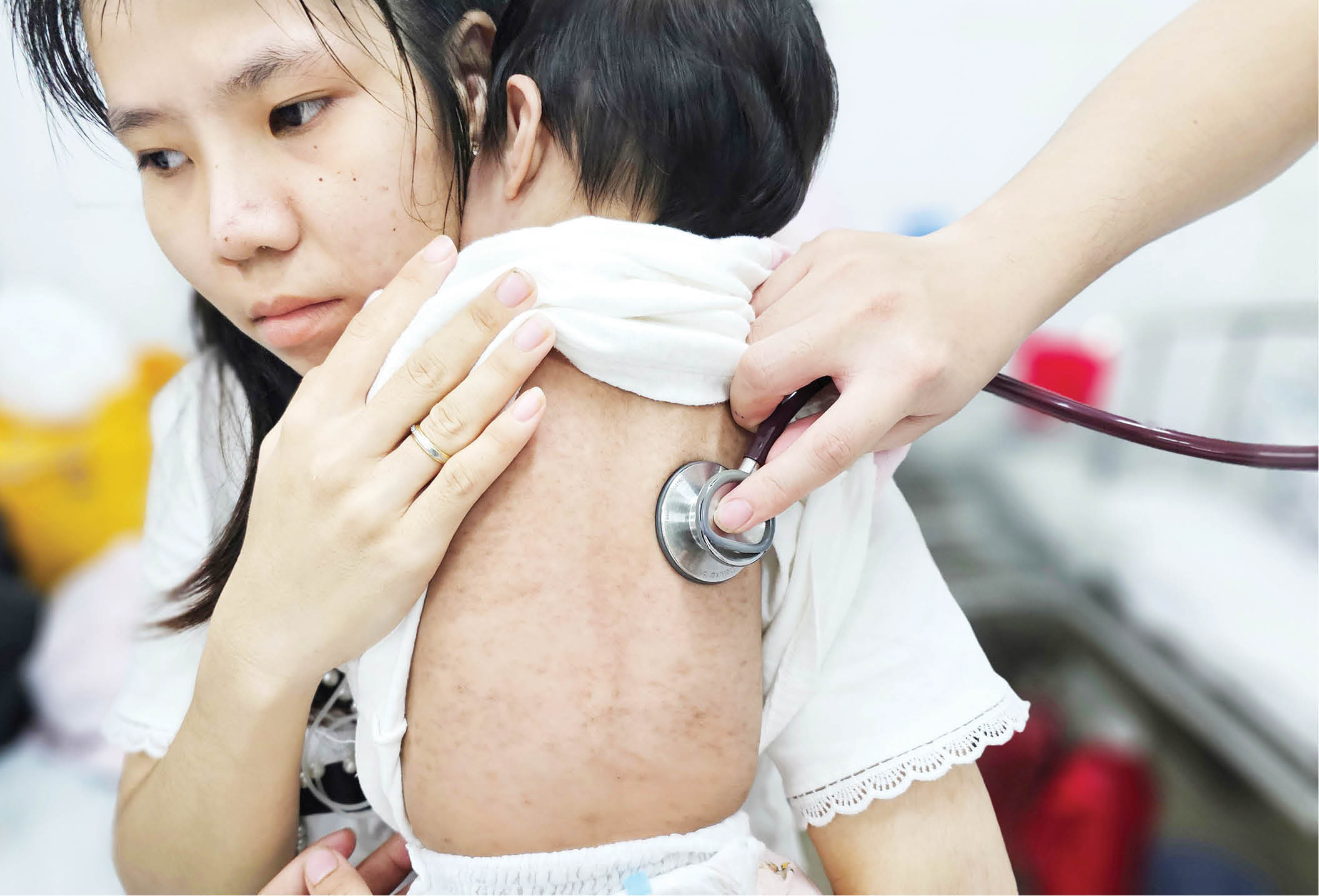 Kiểm soát bệnh sởi, khuyến khích tiêm vắc-xin dự phòng