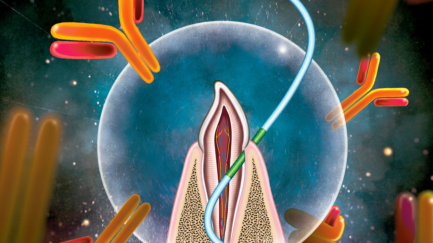 Thử nghiệm chỉ nha khoa thay thế kim tiêm vắc-xin