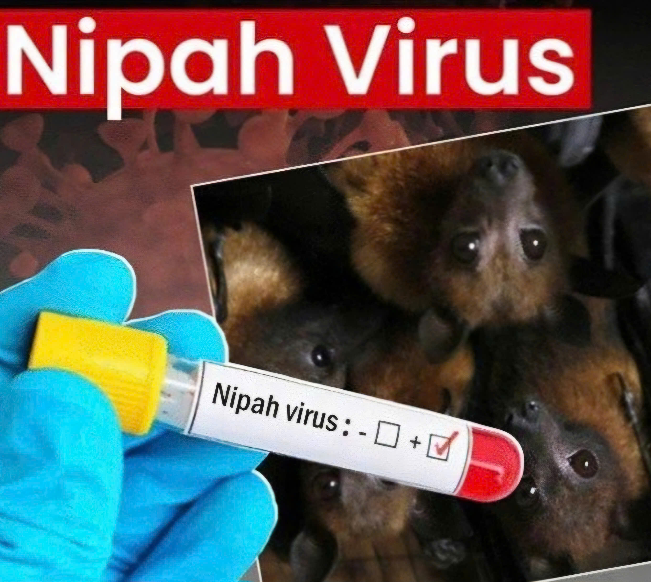 Yêu cầu các cơ sở y tế và địa phương tăng cường giám sát dịch bệnh do vi rút Nipah