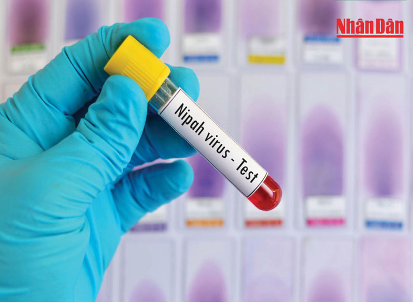 Châu Á quyết liệt phòng, chống virus Nipah