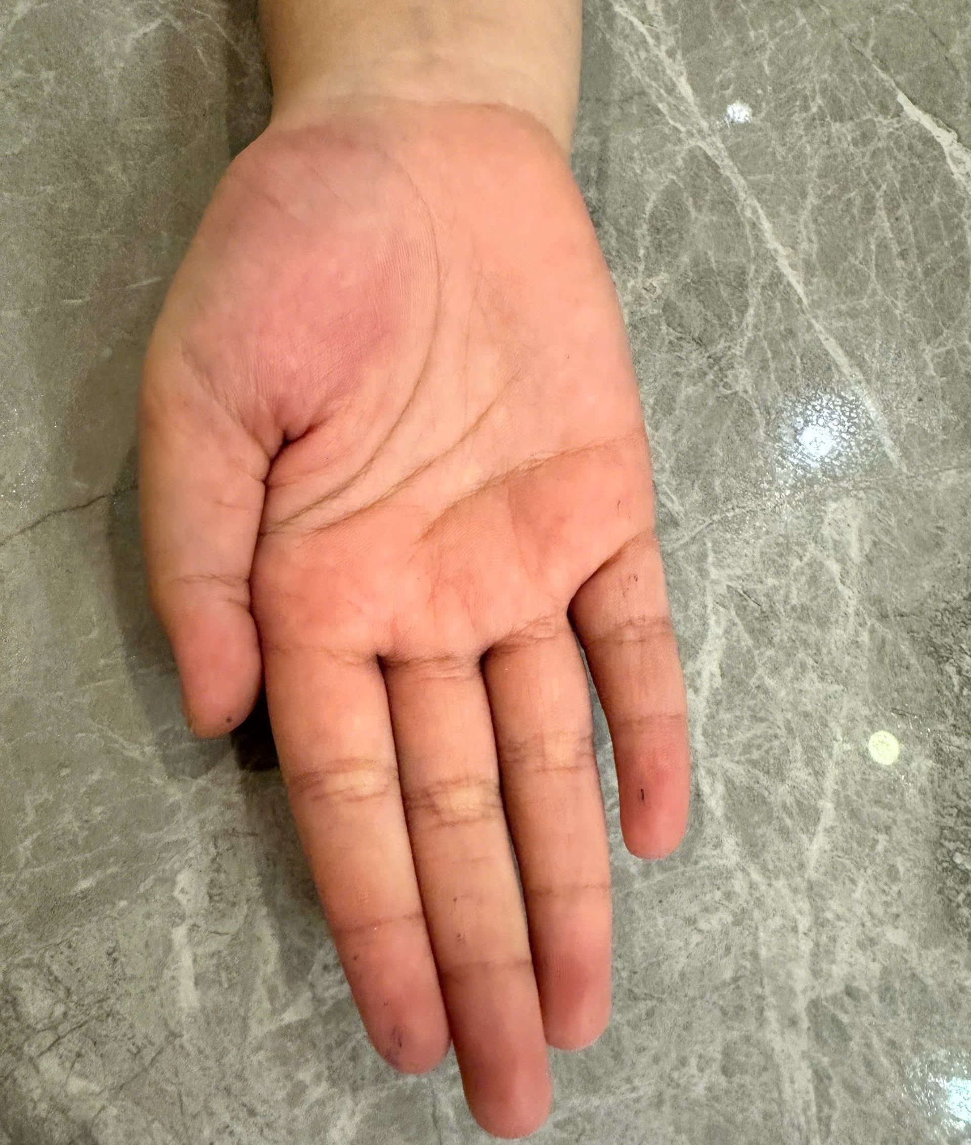 Không để tái diễn các phương pháp giáo dục không phù hợp