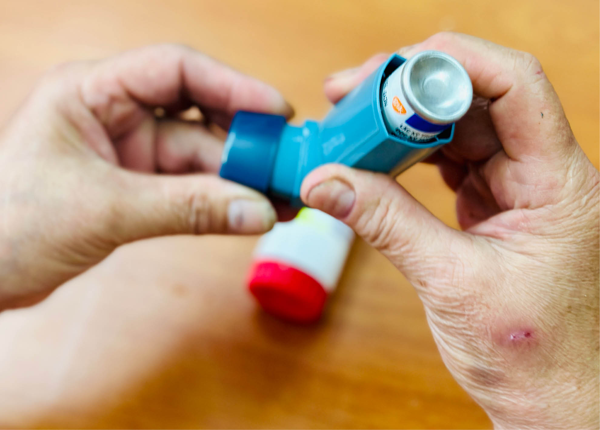 Dự phòng hen khi thời tiết thay đổi