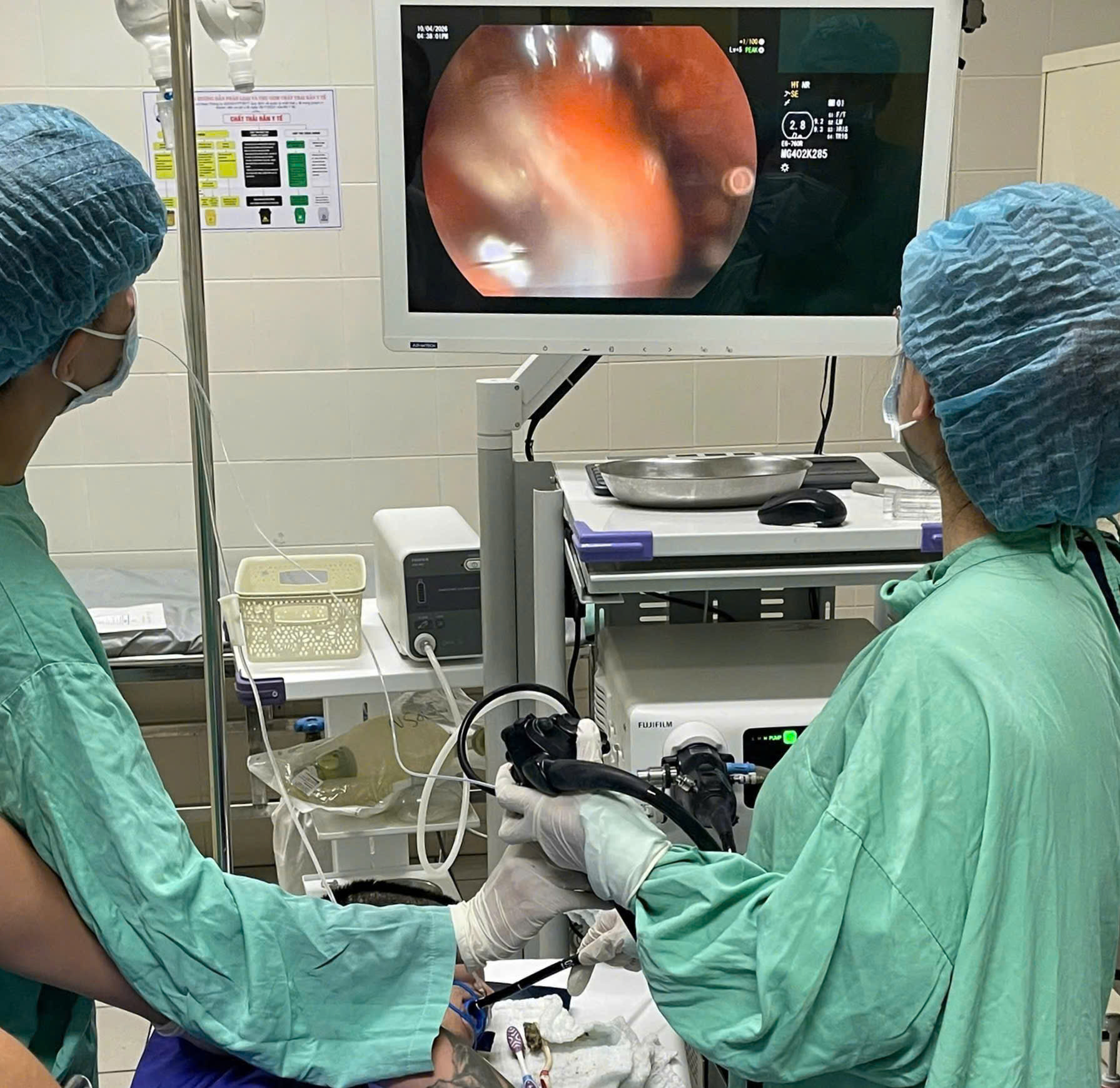 Bệnh viện Trung ương Huế nội soi gắp thành công 3 bàn chải trong dạ dày bệnh nhân