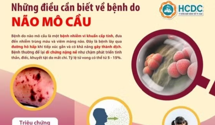 Phát hiện sớm và điều trị kịp thời bệnh do não mô cầu có ý nghĩa quan trọng hạn chế biến chứng nặng và tử vong