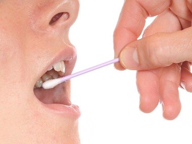 Chế tạo dụng cụ phát hiện nhanh ung thư qua thử nước bọt