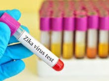 Bộ Y tế 200 mẫu bệnh phẩm xét nghiệm virus Zika cho kết quả âm tính