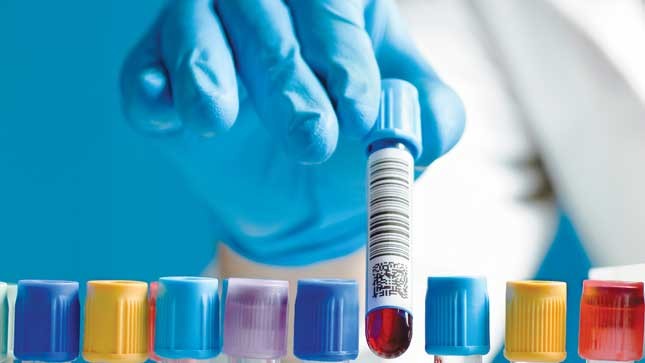 FDA khuyến cáo cần kiểm tra mẫu máu được hiến trước nguy cơ lây nhiễm Zika