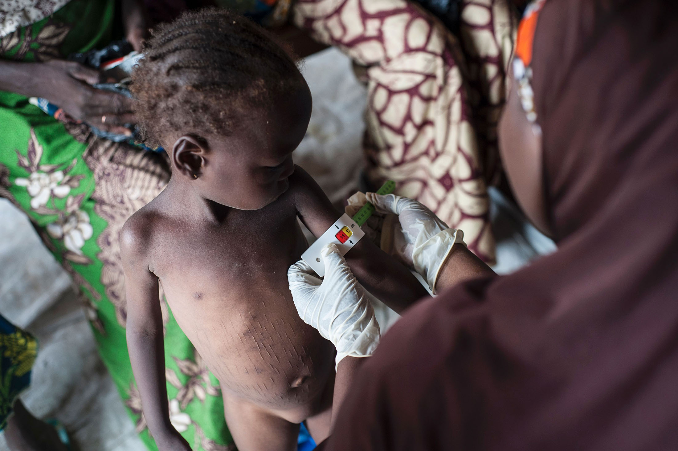 UNICEF báo động tình trạng khủng hoảng lương thực nghiêm trọng nhất thế giới tại Nigeria