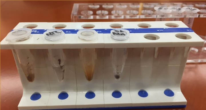 Singapore công bố bộ dụng cụ xét nghiệm sốt xuất huyết trong 10 phút