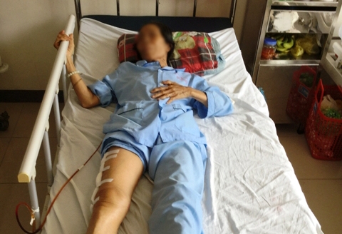 Phẫu thuật thành công bệnh nhân gãy xương đùi dị ứng nhiều loại thuốc
