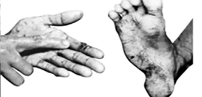 Thực hư về asen trong nước mắm