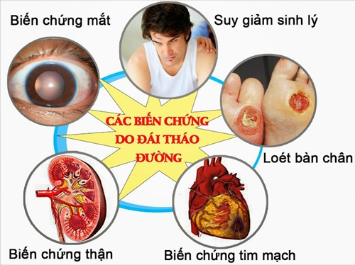 Người đái tháo đường ở VN tăng cao hơn thế giới