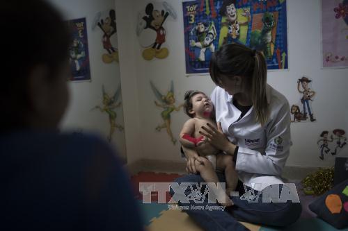 Virus Zika có thể nhân bản trong não trẻ