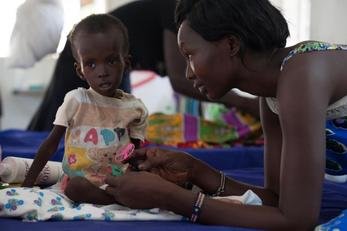UNICEF báo động tình trạng suy dinh dưỡng và bệnh tật ở trẻ em Somali