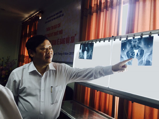 Kỹ thuật mới điều trị hiếm muộn