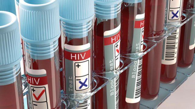 Đột phá mới tìm ra phương pháp tạo tế bào kháng virus HIV