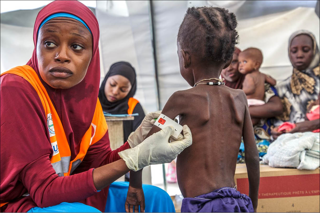 LHQ kêu gọi hành động trước nạn đói nghiêm trọng ở châu Phi