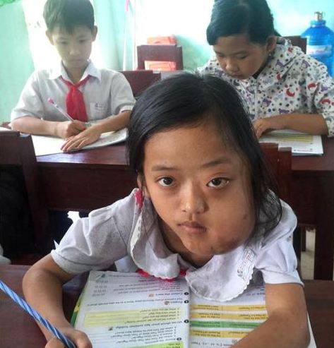 “Đến trường giúp con quên đau”