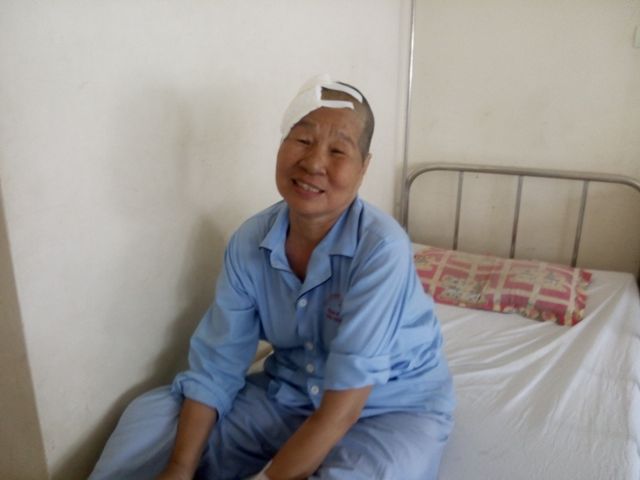 Phẫu thuật thành công bệnh nhân có khối u ở não dài 5cm trong trạng thái động kinh