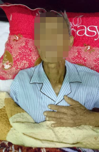 Cứu sống cụ ông bị u tắc mật trong gan