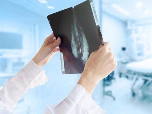 Bảo hiểm Y tế cần thanh toán cho tầm soát, chẩn đoán sớm ung thư