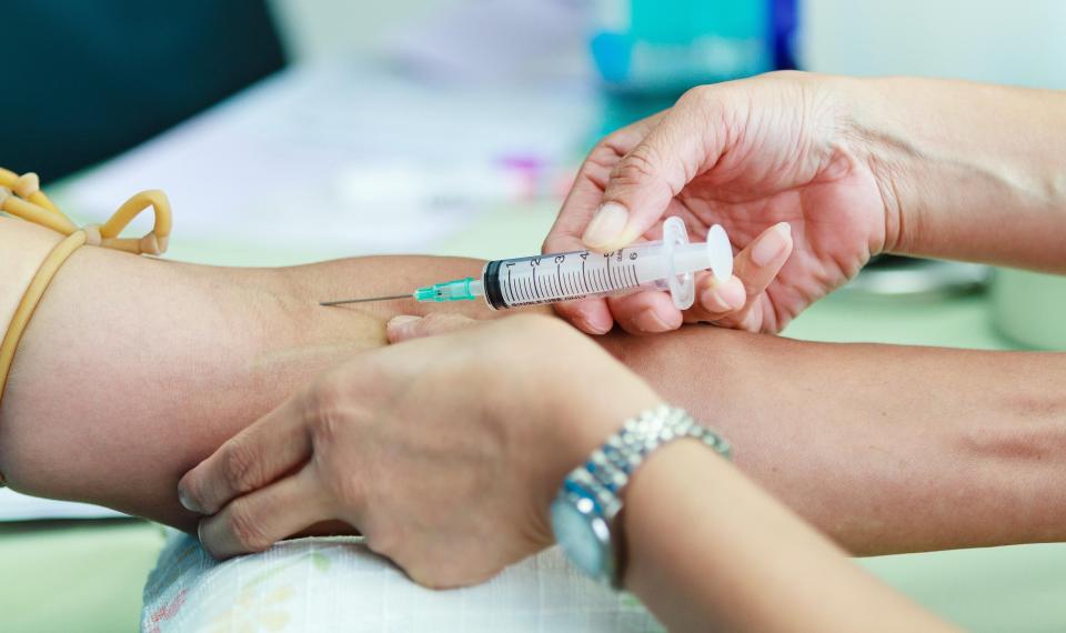 Xét nghiệm máu có thể phát hiện ung thư da tái phát