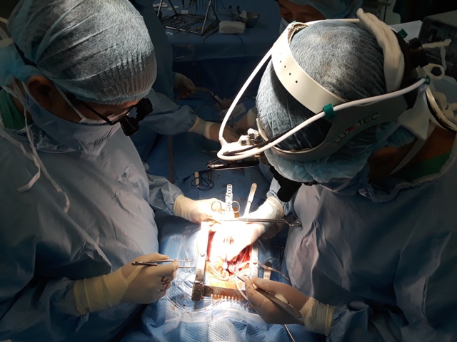 The second trans Viet heart transplant was successfully performed