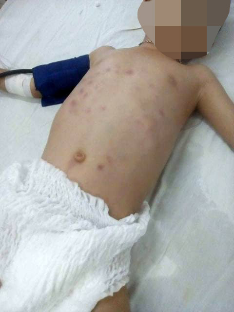 Bắt khẩn cấp đối tượng bạo hành trẻ em