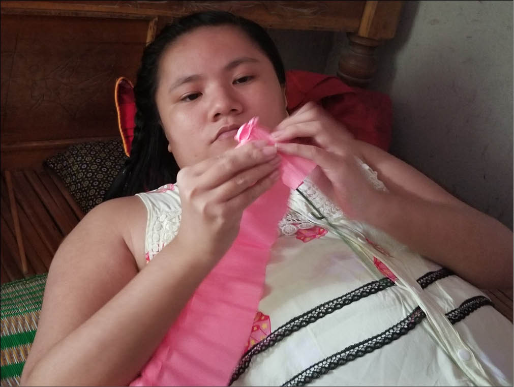 Nghị lực của cô gái mang căn bệnh xương thủy tinh