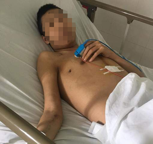 Quyên góp kinh phí phẫu thuật, cứu sống phạm nhân bị bệnh tim nặng