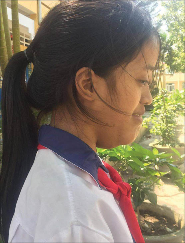 Hoàn cảnh đáng thương của nữ sinh lớp 7