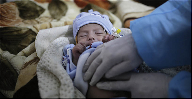 Yemen Dịch tả tái bùng phát mạnh ở trẻ em