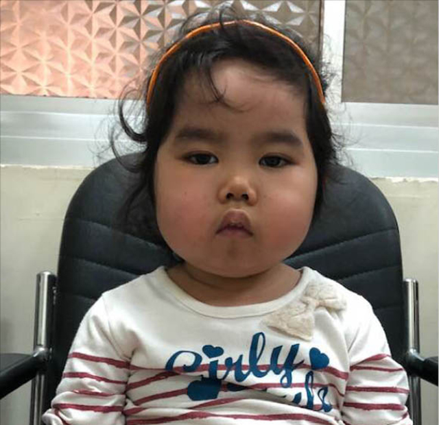 Không tiền mua thuốc, bé có nguy cơ bị tàn tật