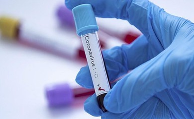 Các phòng thí nghiệm có thể làm xét nghiệm Covid-19 ở Việt Nam