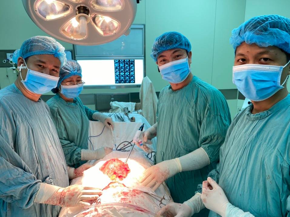Lấy thành công khối u 9kg từ ổ bụng bệnh nhân