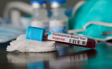 Thêm 2 ca mắc Covid-19 mới, đều là người trồng hoa ở thôn Hạ Lôi, Mê Linh