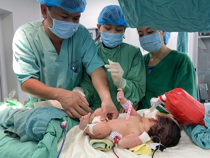 Nong van động mạch phổi cho trẻ 5 ngày tuổi