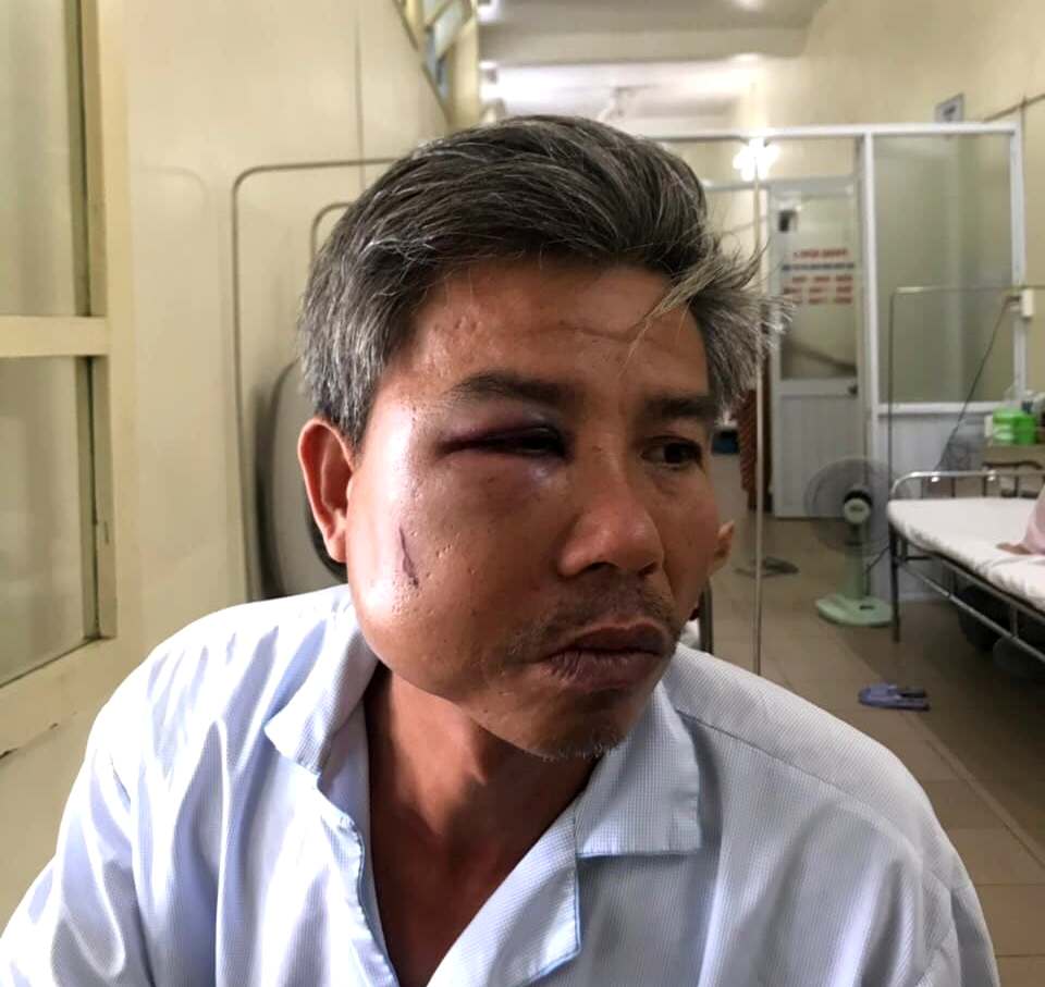 Khởi tố chủ quán “Bố Già” gây thương tích với nhân viên Trung tâm Công viên cây xanh Huế