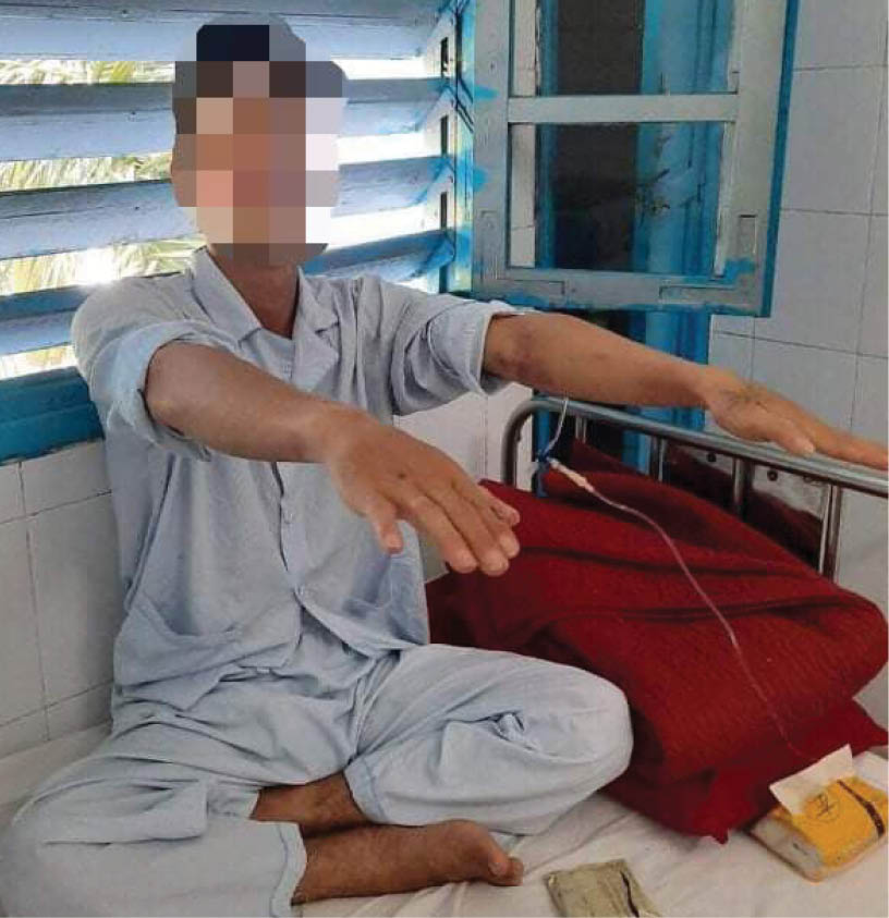 Ý nghĩa sống còn của cấp cứu ngưng tuần hoàn ngoại viện