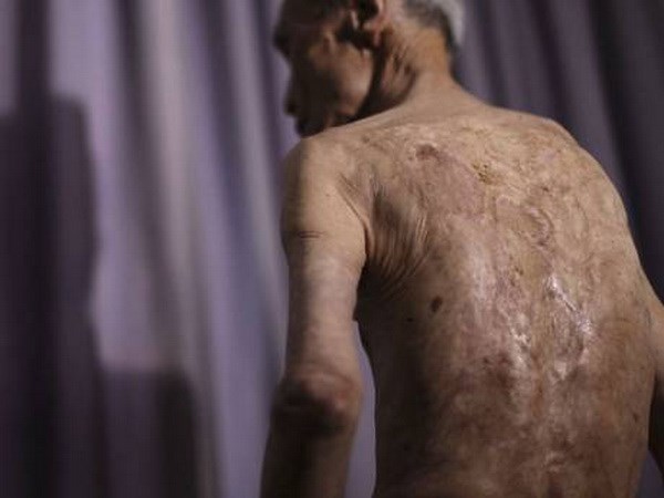 Hiroshima, Nagasaki hối thúc Nhật ký, phê chuẩn hiệp ước cấm vũ khí hạt nhân của Liên Hiệp quốc