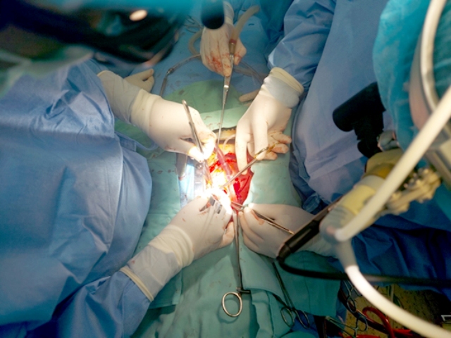 Áp dụng phẫu thuật HYBRID điều trị động mạch chủ thành công với tỷ lệ 98